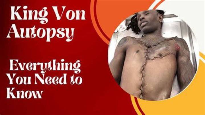 King Von Autopsy Cause of Death: Revealed