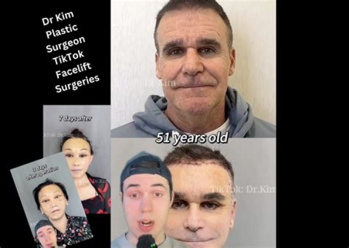 The Comprehensive Guide to Don Johnson's Plastic Surgery Saga
