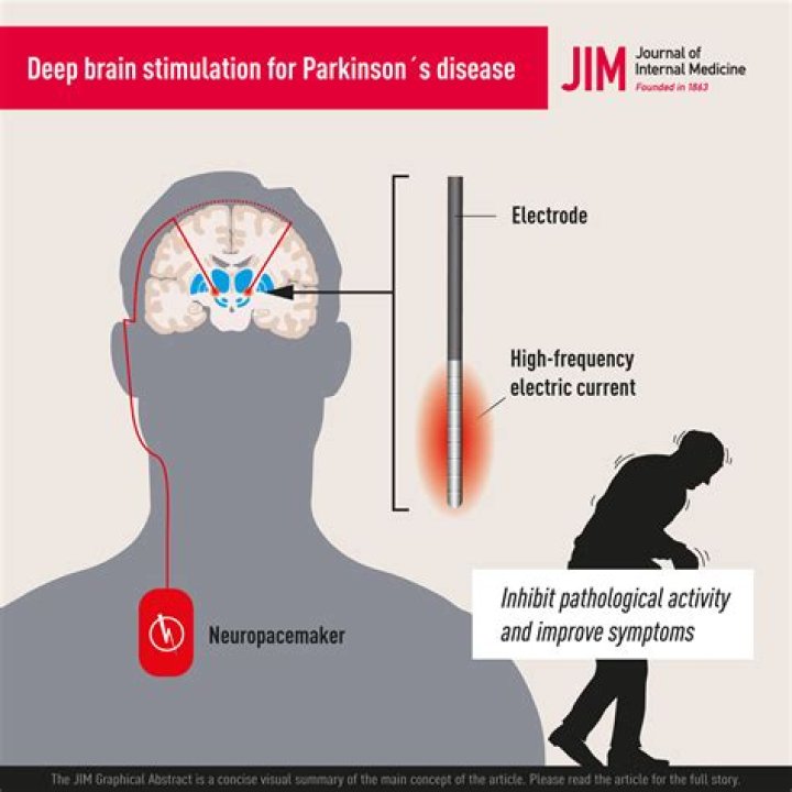 Understanding Julian McMahon and His Journey with Parkinson's Disease